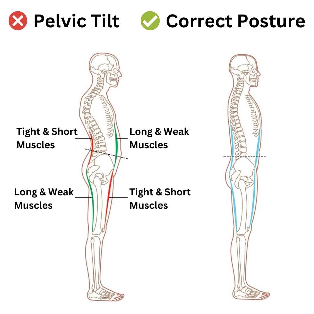 Munsyn™ FlexSpine Stretcher